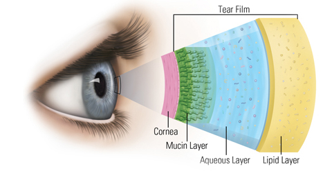 How can I have “Dry Eye Syndrome” when my eyes don’t feel dry? – Leeds